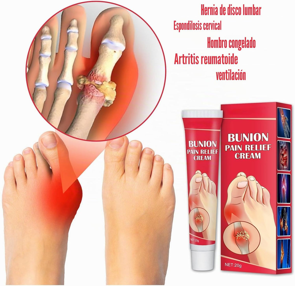 Crema para aliviar las molestias de los juanetes